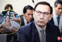 Martín Vizcarra denuncia que perdió el riñón izquierdo por demora en traslado a clínica