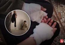 Vecinos denuncian que padrastro quemó y «torturó» a menor de 11 años: familiares habrían presenciado ataques y no denunciaron