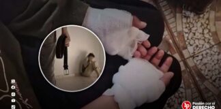 Vecinos denuncian que padrastro quemó y «torturó» a menor de 11 años: familiares habrían presenciado ataques y no denunciaron